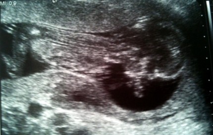 14. týden 14. týden