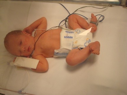 jednym ockom jednym ockom